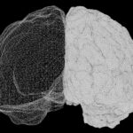 best occipital nerve simulation for migraine in 2026