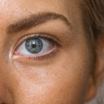 an eye strain causing migraine