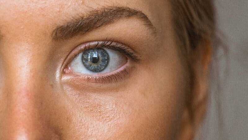 Can Eye Strain Cause Migraines: The Eye and Head Connection