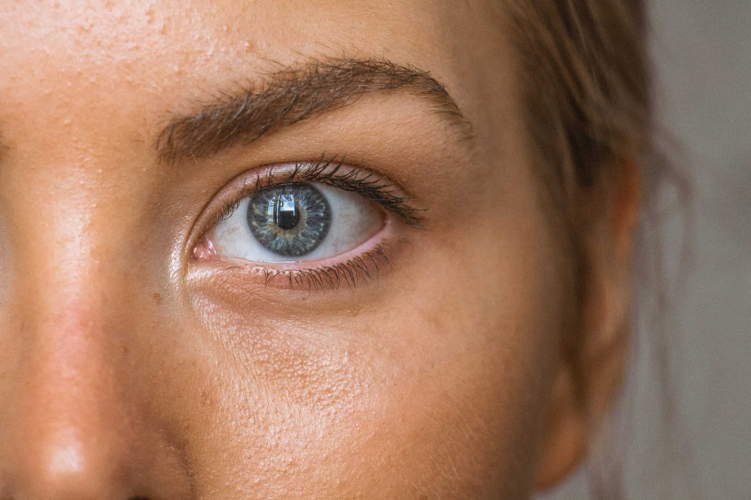 Can Eye Strain Cause Migraines: The Eye and Head Connection
