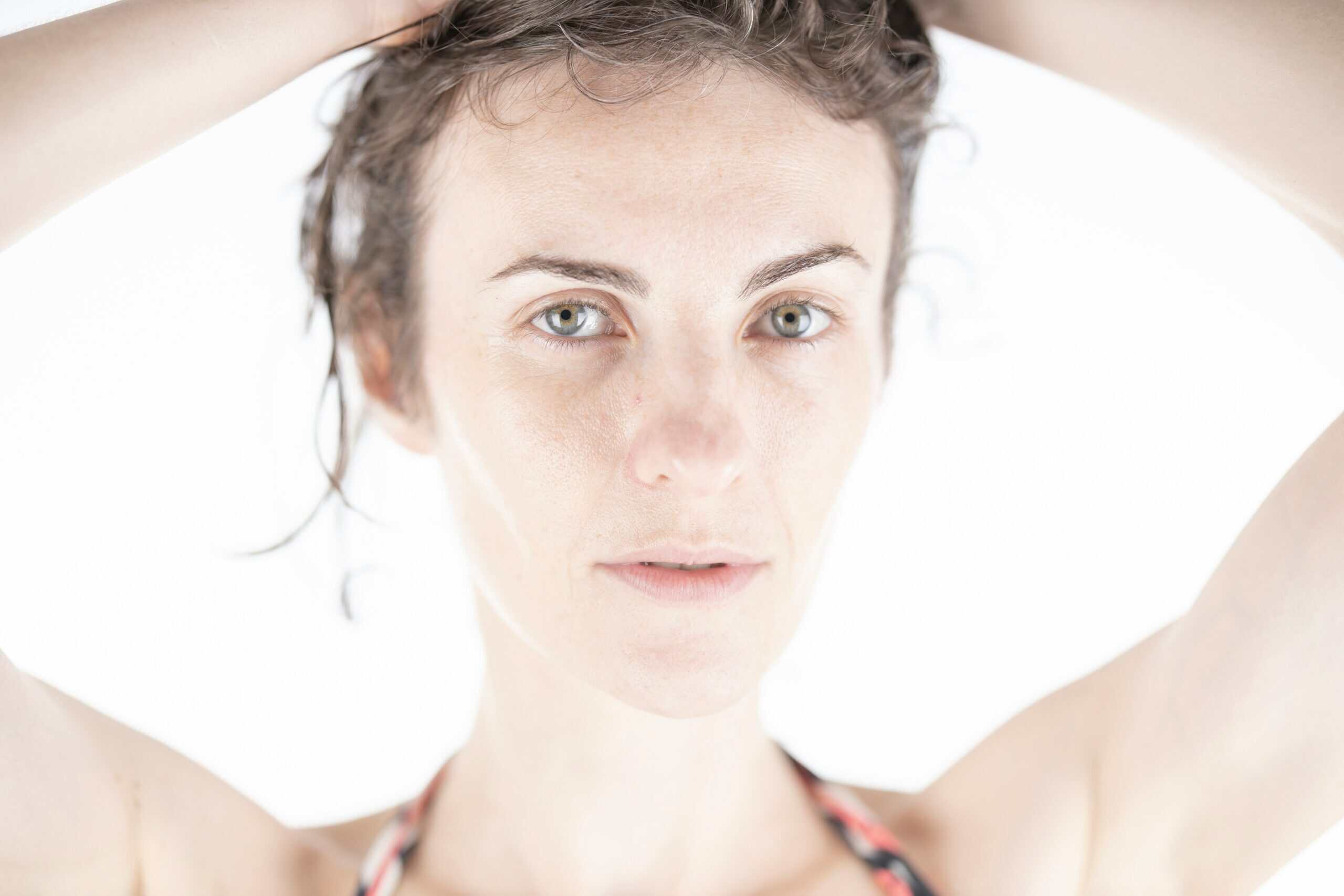 Why Does My Migraine Come Back the Next Day: Recurrence, Medication Timing, and Rebound