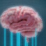 neurological brain fuzzy picture