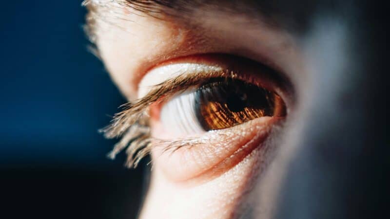 Can Dry Eye Cause Headaches: The Indirect Route From Tear Film to Head Pain