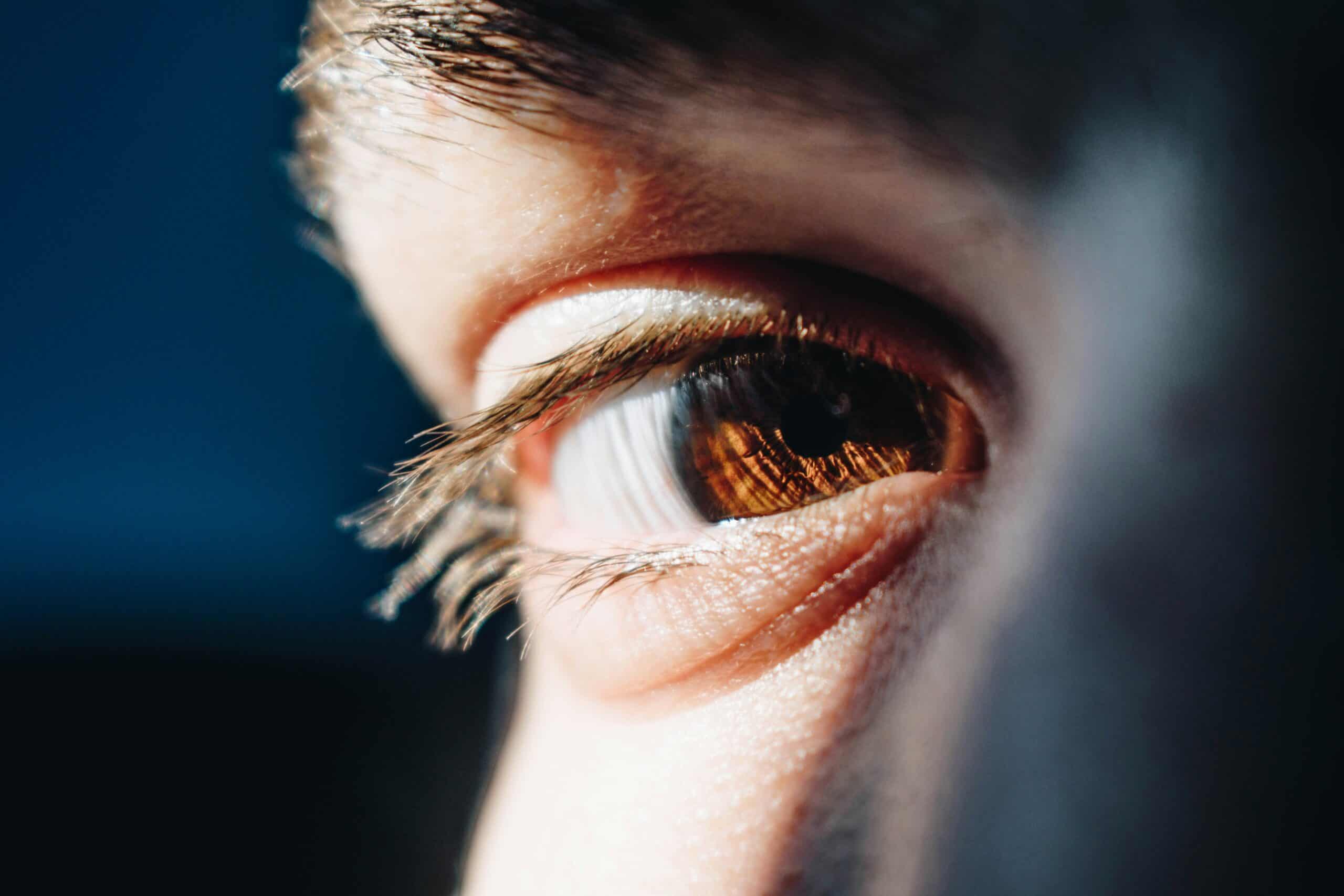 Can Dry Eye Cause Headaches: The Indirect Route From Tear Film to Head Pain