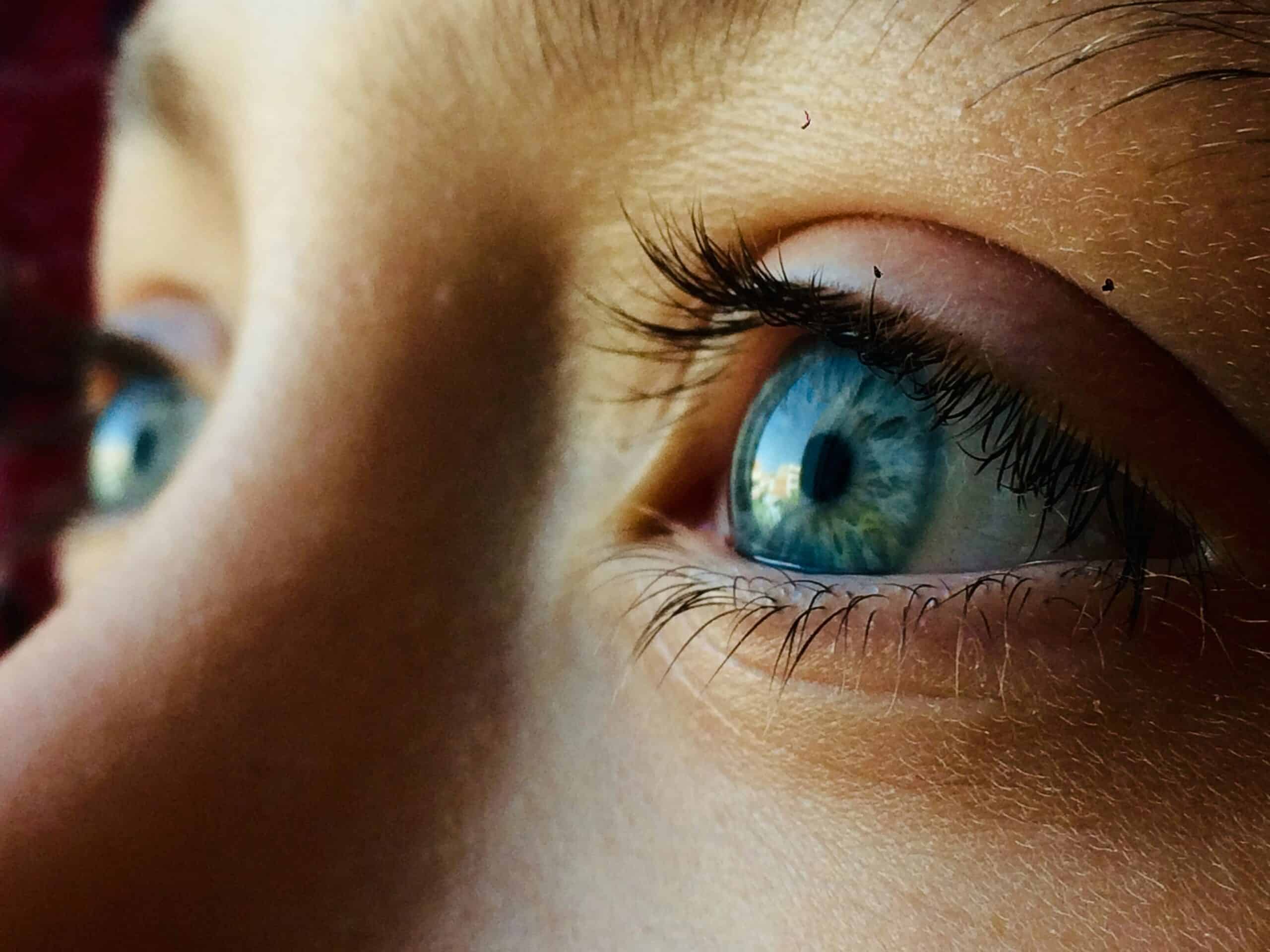 Can Contact Lenses Cause Headaches: Dryness, Fit, Rotation, and Power Differences