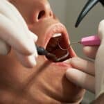 someone getting dental work done