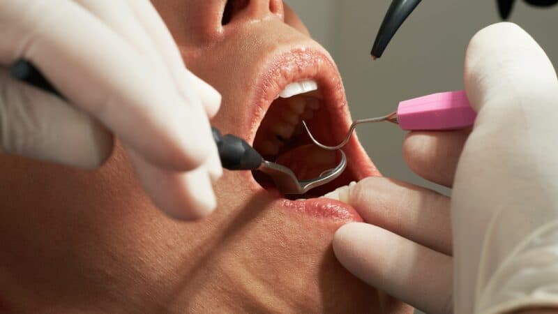 Can Dental Work Trigger a Migraine? What Happens in the Chair and How to Plan Around It