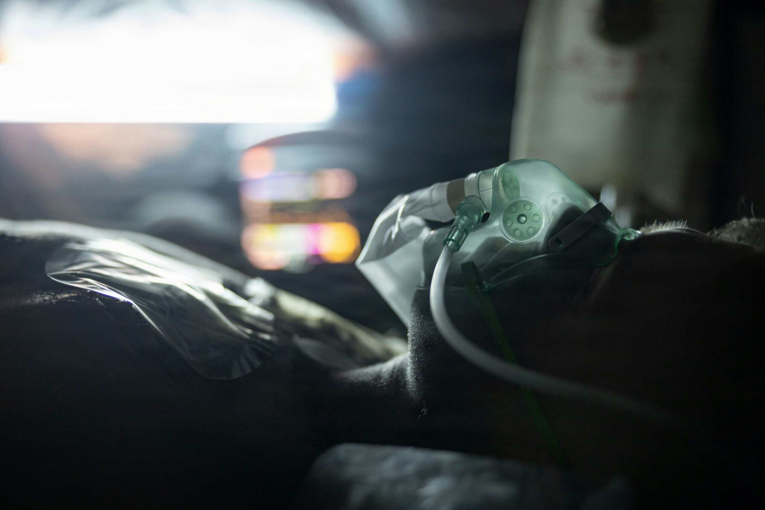 Migraine and Sleep Apnea: How the Two Are Connected and How Doctors Tell Them Apart